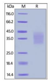 SDS-PAGE (KITLG-520H).jpg